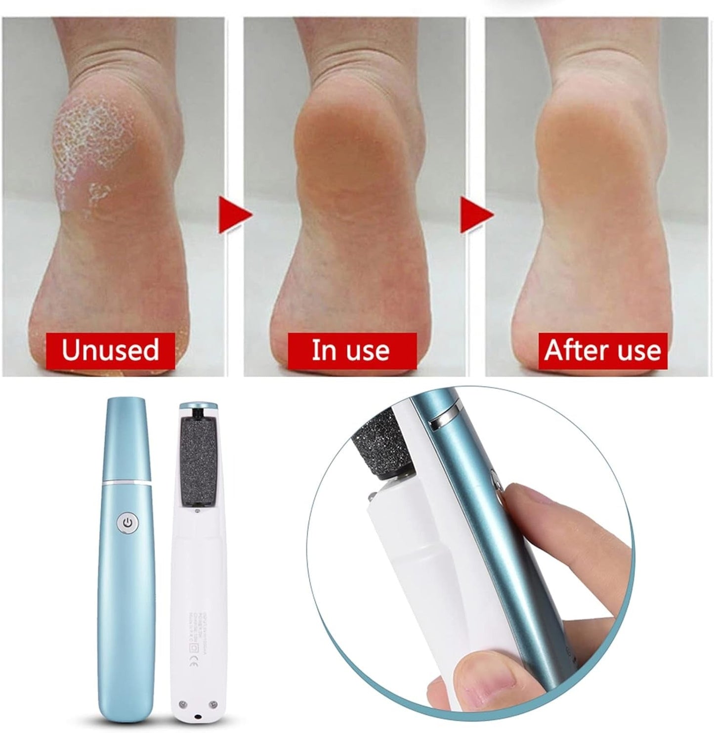 CallusGrinder 1+1 GRATIS - Elektrische Voetslijper Eeltverwijderaar