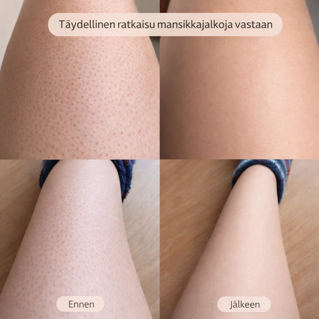 SilvaTrim – 2-in-1 karvanpoistaja sileään ihoon