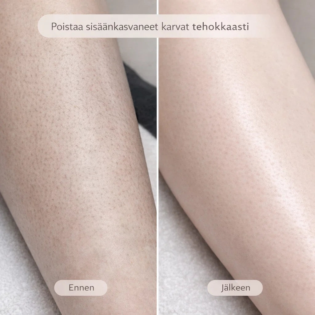SilvaTrim – 2-in-1 karvanpoistaja sileään ihoon