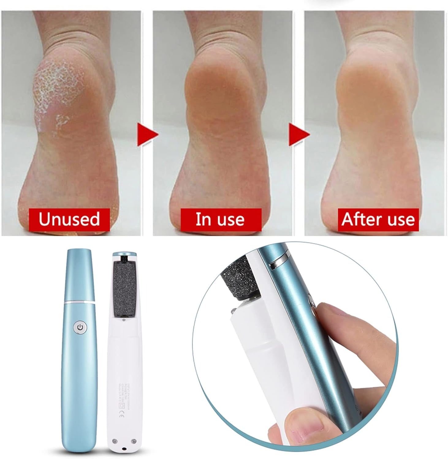 CallusGrinder 1+1 GRATIS - Elektrische Voetslijper Eeltverwijderaar