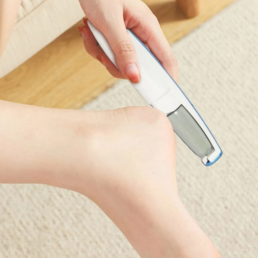 CallusGrinder 1+1 GRATIS - Elektrische Voetslijper Eeltverwijderaar