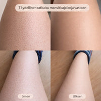 SilvaTrim – 2-in-1 karvanpoistaja sileään ihoon