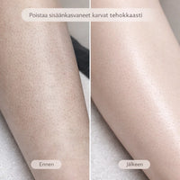 SilvaTrim – 2-in-1 karvanpoistaja sileään ihoon